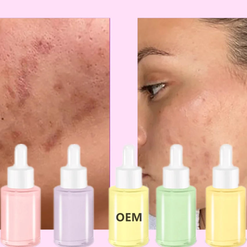 Korean Cosmetic Skincare Facial Essence Milk Serum Organic Whitening Natural Fruit Extract Skin Care Face Serum