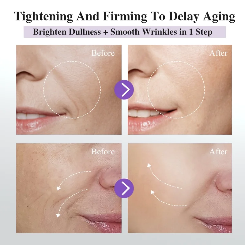 Private Label Organic Bakuchiol Collagen Retinol Niacinamide Age-Aging Face Serum Skin Care Product Facial Korean Skincare D