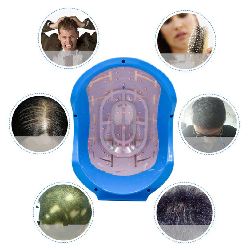Fast Improve Bald Men Anti Hair Loss Care Laser Hair Regrowth